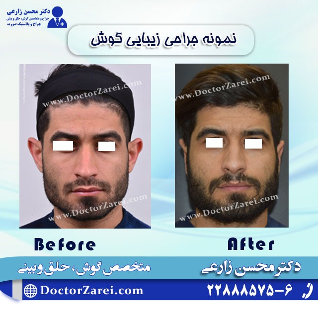 جراحی بینی دکتر محسن زارعی